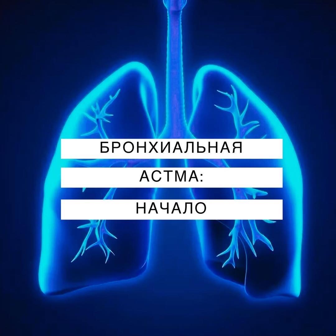 Бронхиальная астма. Начало